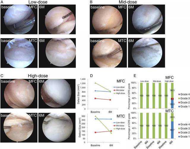 MAIA研究最新成果：含Dara的方案能显著改善不适合移植NDMM患者的健康相关生活质量